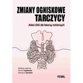 Zmiany ogniskowe tarczycy. Atlas USG dla lekarzy rodzinnych